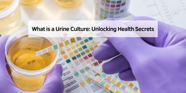 What is a Urine Culture