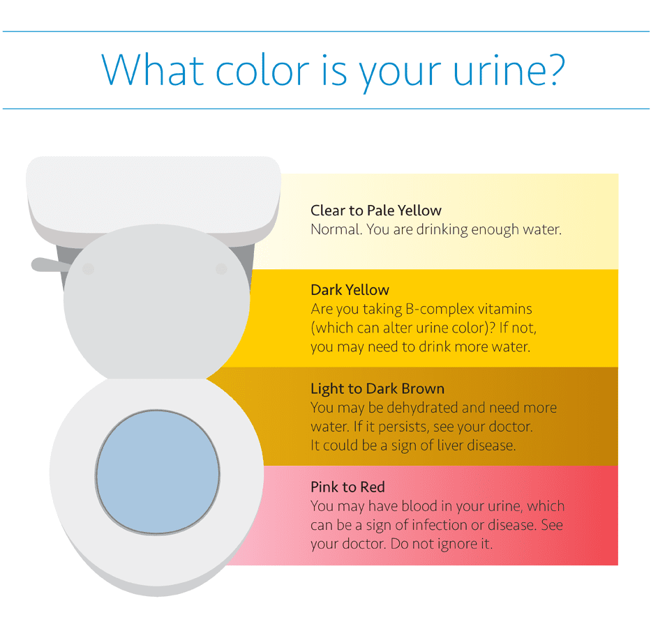Why is My Urine Darker in the Morning