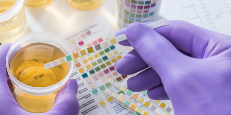 Average Costs of Urine Tests in the USA
