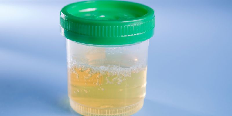 How to Prevent Foamy Urine