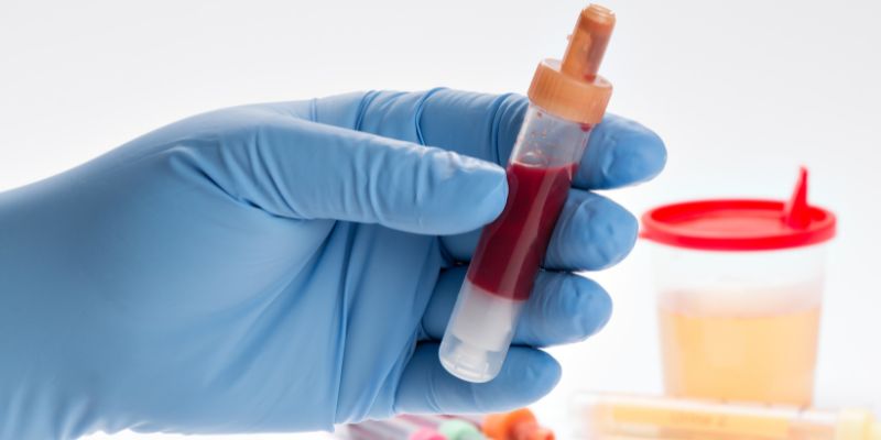 What Causes Blood in Urine