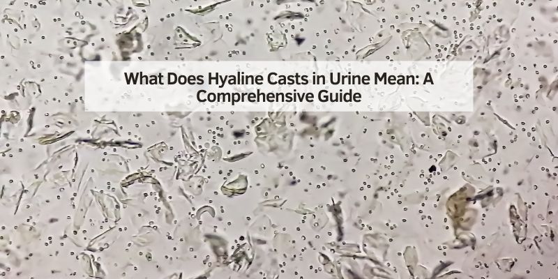 What Does Hyaline Casts in Urine Mean