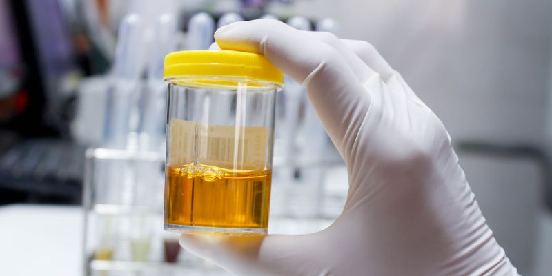 When to See a Doctor About Urine Production