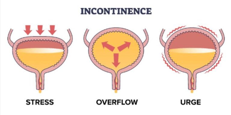 Why Do I Urinate So Much at Night