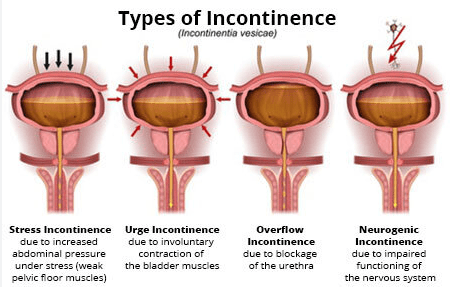 Lifestyle Changes That Helped Me