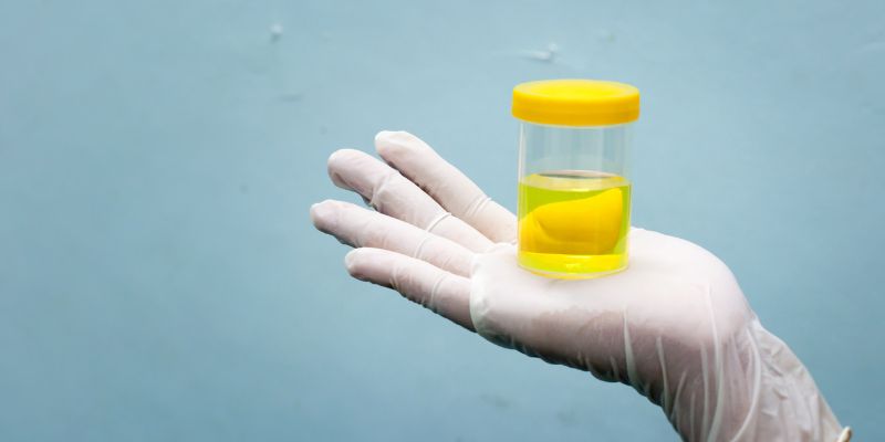 How Long Does Alcohol Stay in Urine