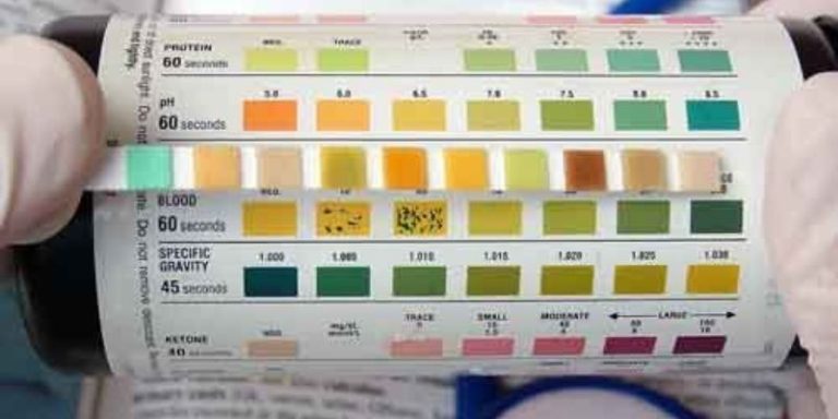 How to Read a Urine Test Strip