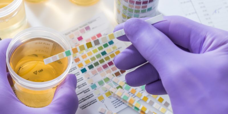 Is Cloudy Urine Normal