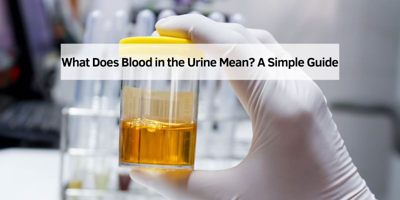 What Does Blood in the Urine Mean
