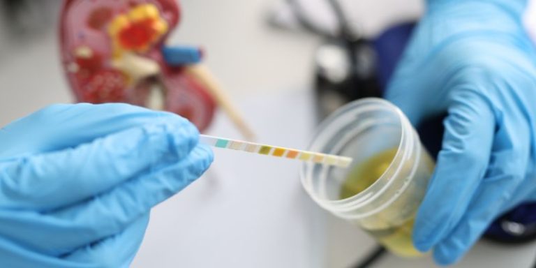 What Does Trace of Ketones in Urine Mean