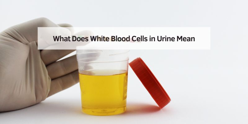 What Does White Blood Cells in Urine Mean