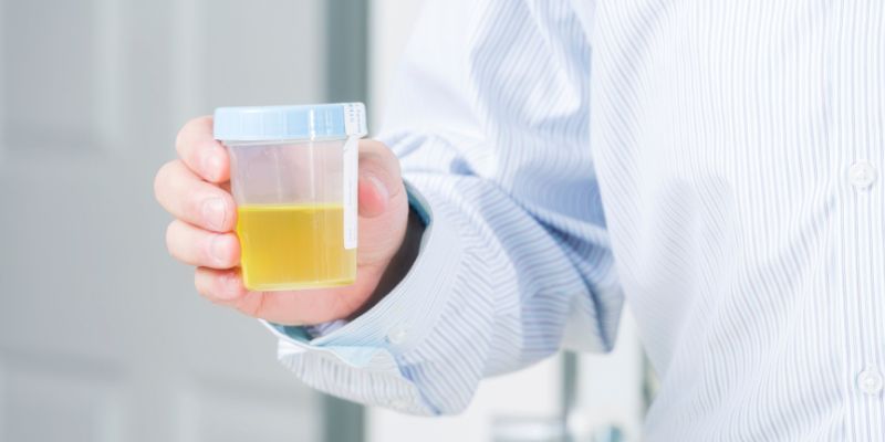 How Do Doctors Find Blood in Your Urine