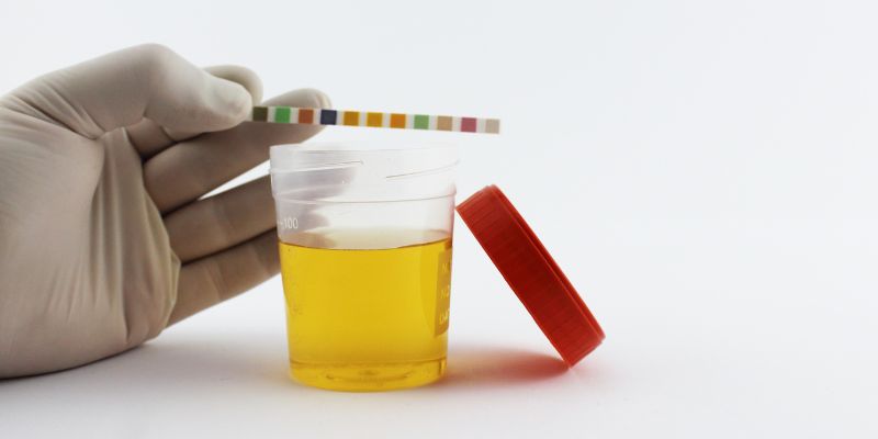 What Causes High Calcium in Urine?