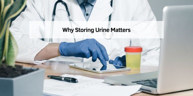 Why Storing Urine Matters