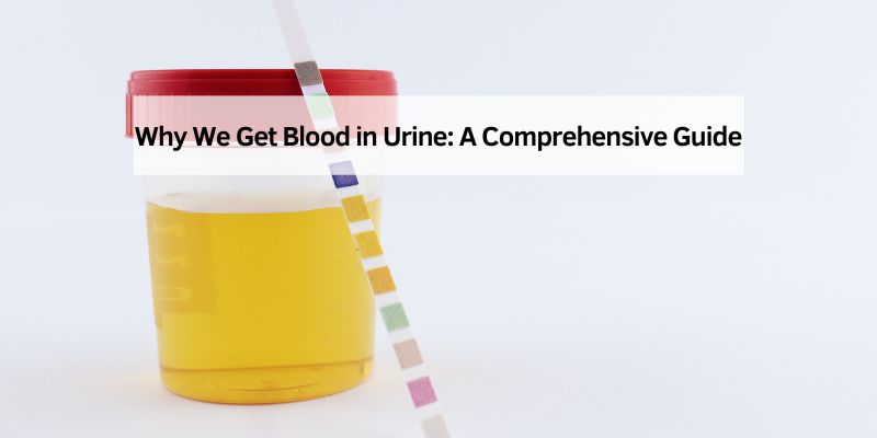Why We Get Blood in Urine