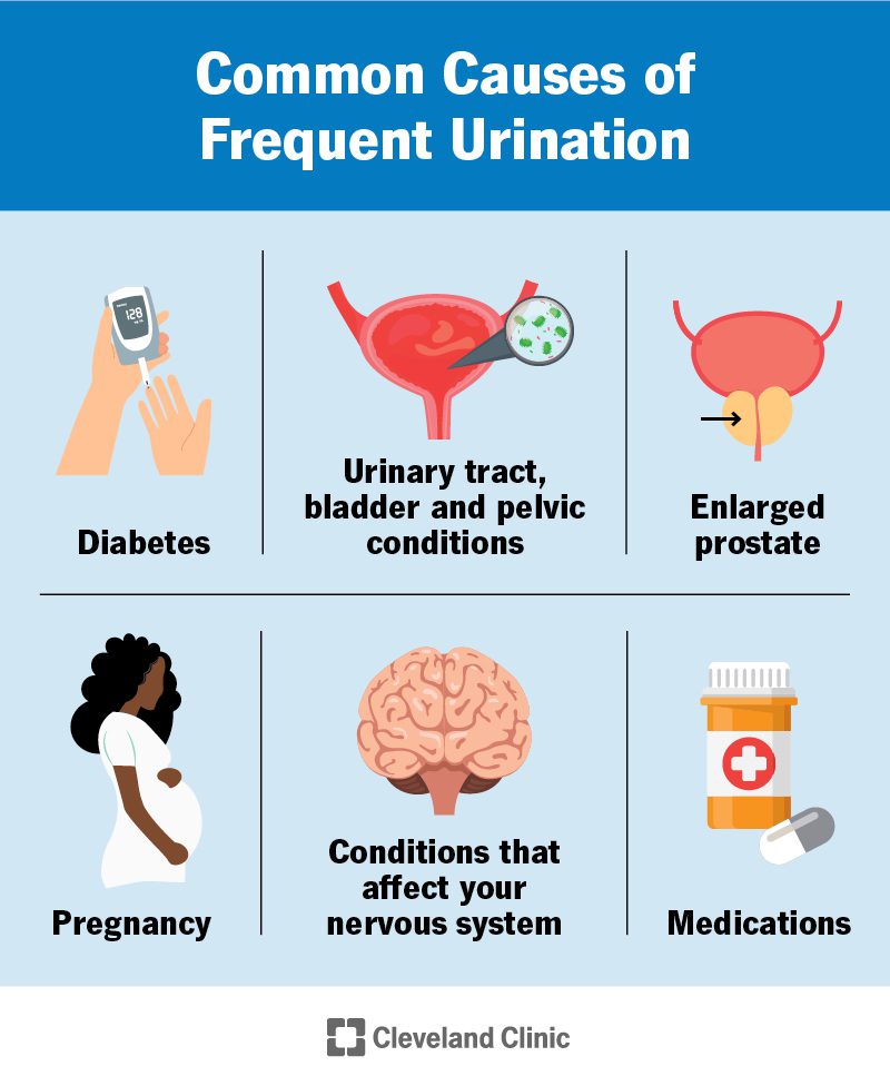 How Often Should You Urinate